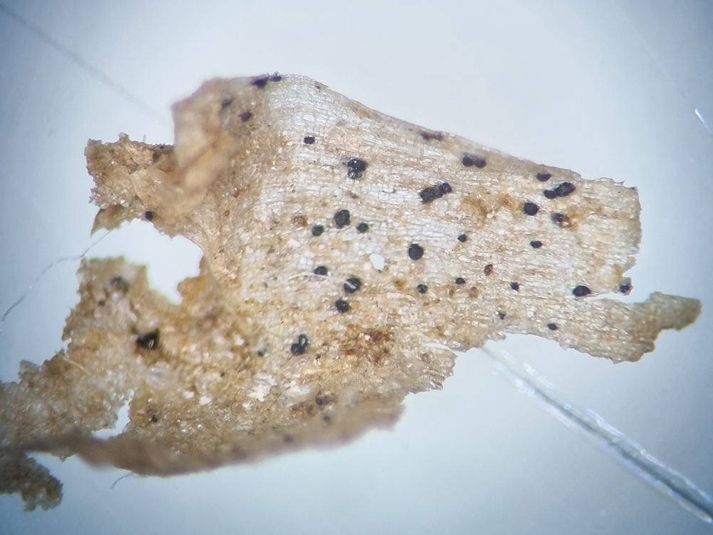 Microscope close-up of potato tissue with multiple small black fungal spots on its surface
